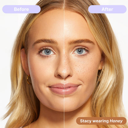 AstridOrganics 5-Point Freckle Stamp