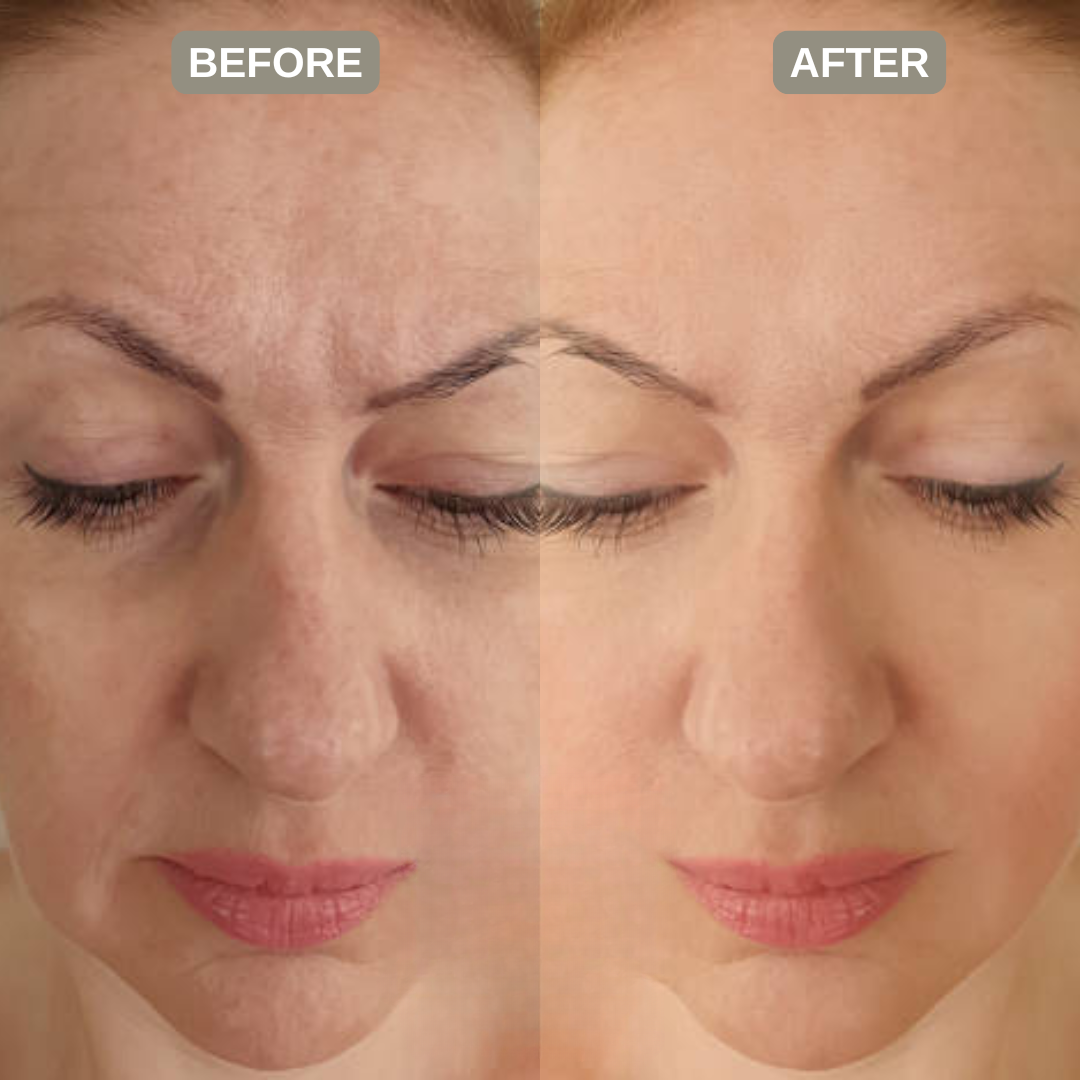 Astrid Organics  PRDN Mask