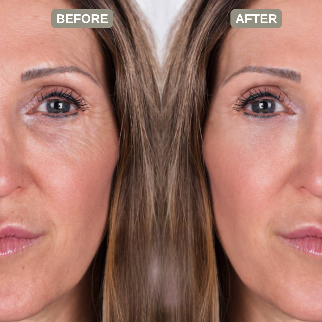 Astrid Organics  PRDN Mask